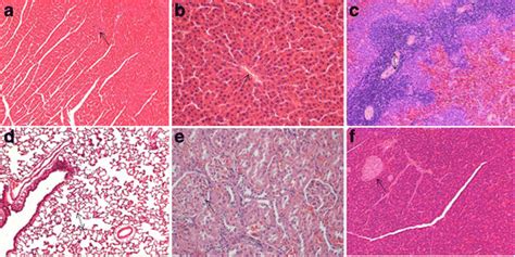 Histopathological Analysis Of Organs Stained With Hande Histopathology