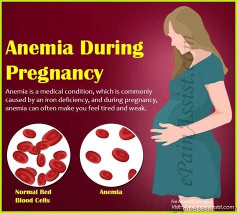 Types Of Anemia In Pregnancy