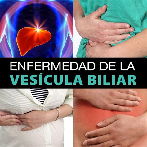 Enfermedad de la vesícula biliar tipos diagnóstico y tratamiento La