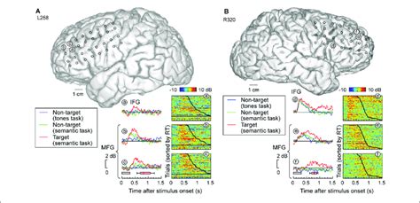 High Gamma Responses Recorded From Prefrontal Cortex Pfc Inferior