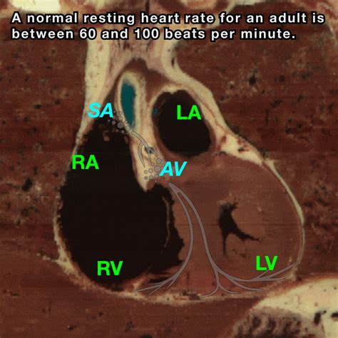 Heart Conduction