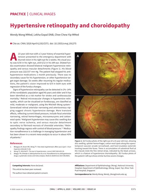 Pdf Hypertensive Retinopathy And Choroidopathy