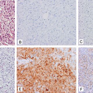 Representative Histological And Immunohistochemical Characteristics Of