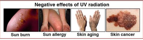 Positive And Negative Effects Of UV Surya Home