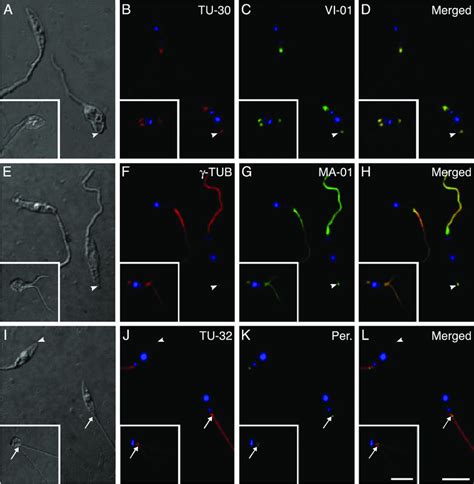 Comparison Of G Tubulin Distribution With Other Cytoskeletal Proteins