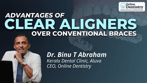 Online Dentistry Pm Advantages Of Clear Aligners Over