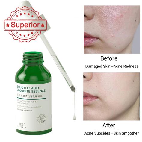 Salicylic Acid Pore Refining Essence Pore Shrinkingandacne Removing