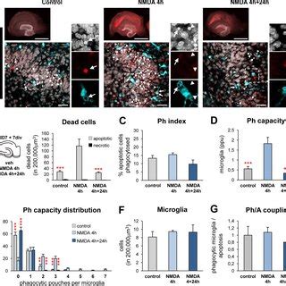 Microglial Phagocytic Response During In Vivo Acute And Chronic