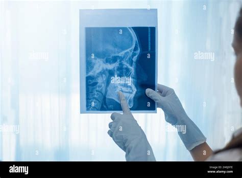 Female Dentist Holding A Dental X Ray Stock Photo Alamy