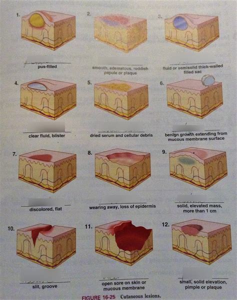 Skin Lesions Chart