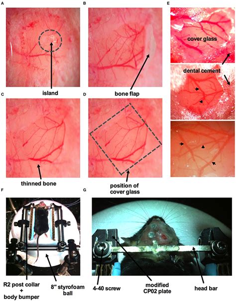 Surgical procedure for craniotomy with dura removal. (A) Image of part ...