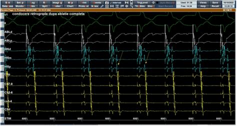 ijmrhs   decremental