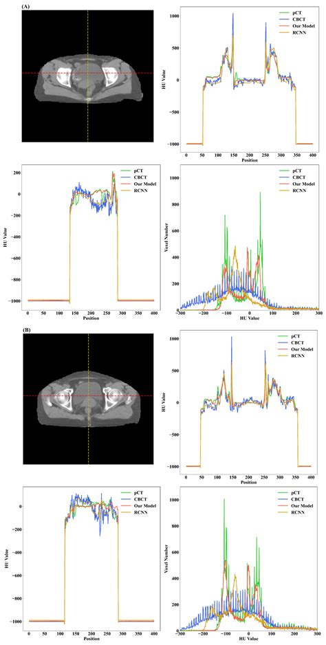 Cancers Free Full Text Cbct To Ct Synthesis For Cervical Cancer