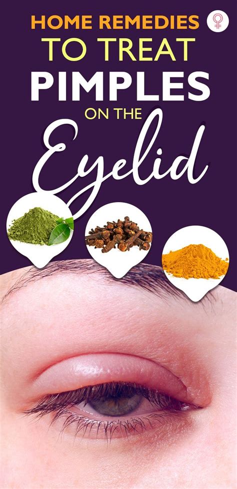 Swollen Eyelids Remedy Artofit