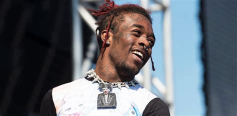 Lil Uzi Verts 24 Million Diamond Implant Was Ripped Out Of Their Head