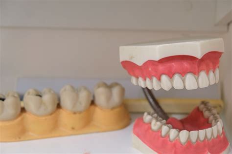 Dental Implant Newcastle Understanding The Causes Of Loose Teeth In Adults The Dental Care