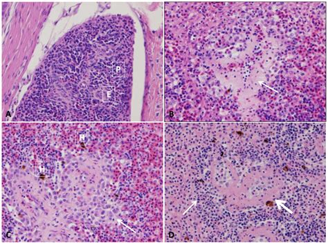 Frontiers Characterization Of Histopathological And Ultrastructural