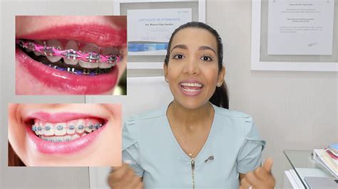 Funci N De Las Ligas De Colores En Los Brackets Youtube