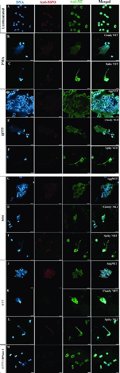 Net Formation Visualization And Effect Of Dnase I Degradation A Download Scientific Diagram