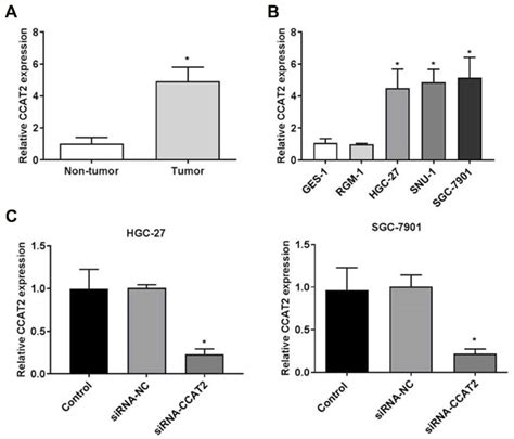 The Expression Of Colon Cancer Associated Transcript Ccat Detected