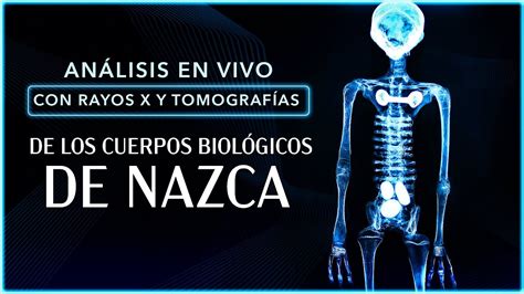 ANÁLISIS EN VIVO con RAYOS X y TOMOGRAFÍAS de los CUERPOS BIOLÓGICOS DE