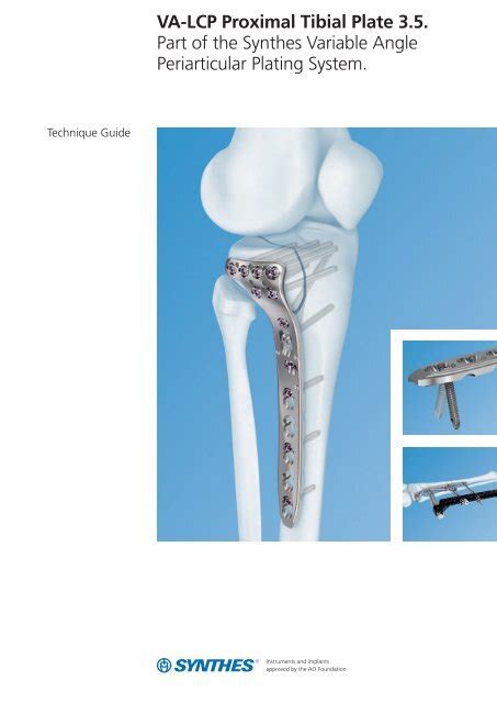 Va Lcp Proximal Tibial Plate Part Of The Synthes Variable Angle