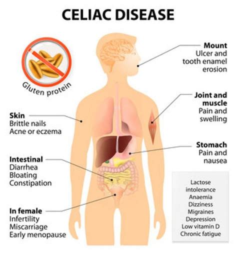 What Is Nighttime Bloating Causes And Treatment