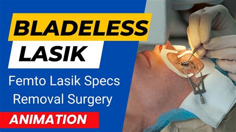 Bladeless Lasik Femto Lasik Specs Removal Surgery Bladeless Lasik