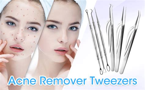 Pimple Popper Tool Kit 6 Pcs Professional Blackhead