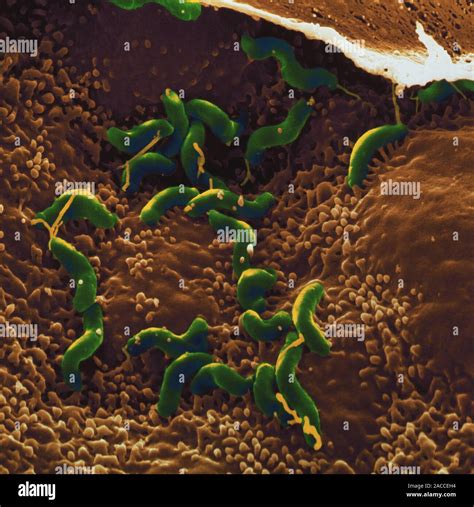 Helicobacter Pylori Bacteria Coloured Scanning Electron Micrograph