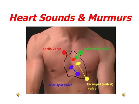 Heart Sounds And Murmurs