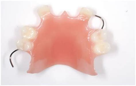 Acrylic Partial Dentures Treatment Service at best price in Dombivli