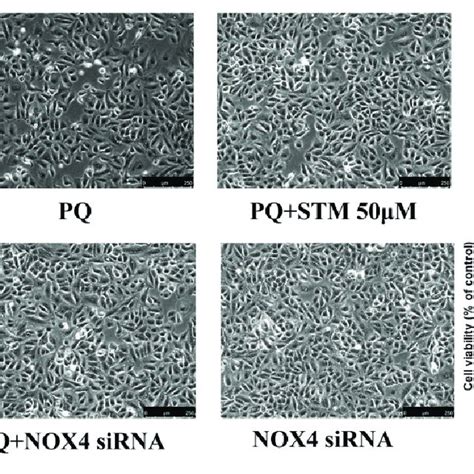 STM Protects A549 Cells Against PQ Induced Cytotoxicity CCK 8 Assays