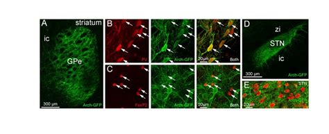 Cre Dependent Viral Expression Of Arch GFP In PV GPe Neurons In PV Cre