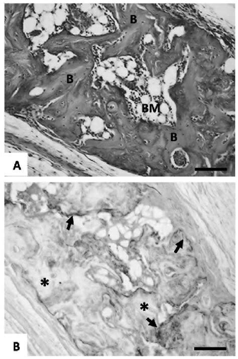 In Vivo Osteogenic Activity Of Rhbmp Cbd Ectopic Bone Formation When