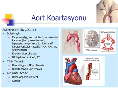 Ppt Aort Koarktasyonu Aortik Nterruption Ve Arkus Aorta Anomalileri