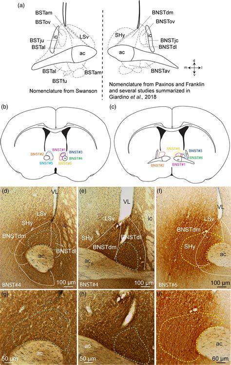 Stria Terminalis Coronal