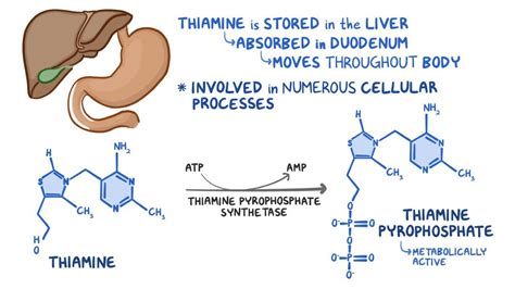 Wernicke-Korsakoff syndrome: Video & Anatomy | Osmosis