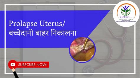 Prolapse Uterus बच्चेदानी बाहर निकालना Pectopexy Best Laparoscopy