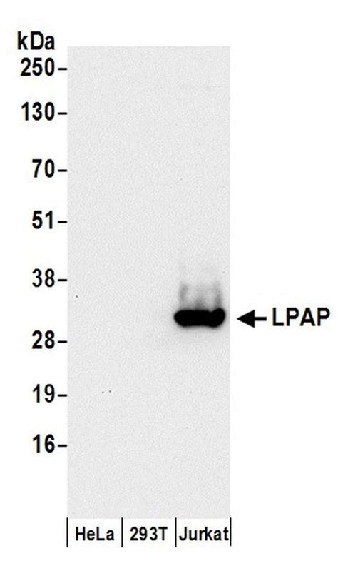 Lpap Polyclonal Antibody A304 456a