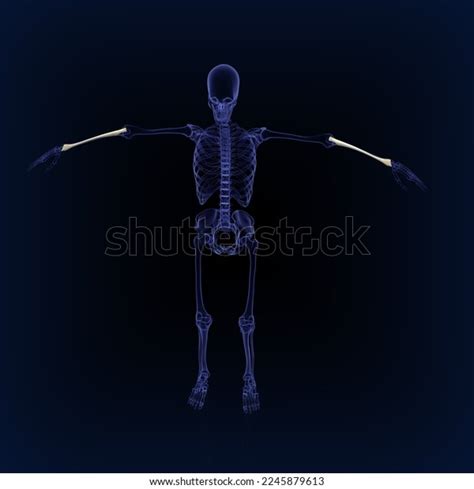 Human Radius Bone Anatomy Medical Illustration3d Stock Illustration 2245879613 | Shutterstock