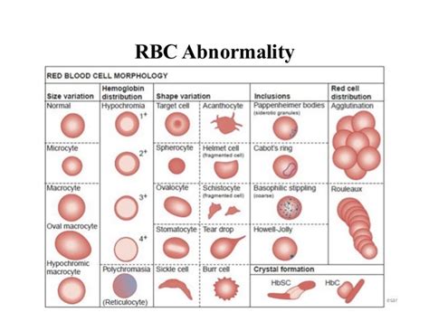 Blood film preparation and reporting