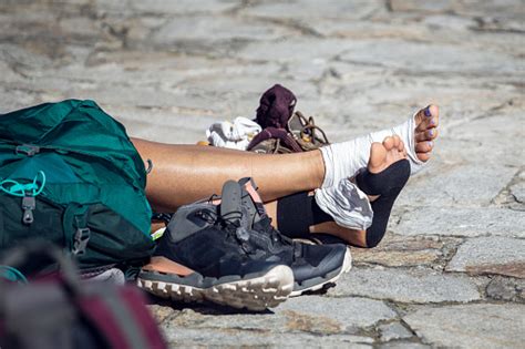 Cuidar Los Pies En El Camino De Santiago Albergues Del Camino