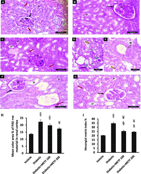 Periodic Schiff Staining For Renal Specimens Photomicrographs Of