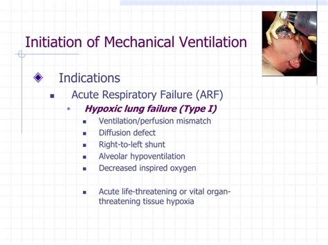 Ppt Principles Of Mechanical Ventilation Powerpoint Presentation