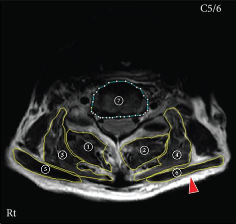 T2 Weighted Magnetic Resonance Mr Sagittal Image A And Axial Image