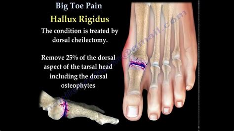 Anatomy Of A Toe - Anatomy Reading Source