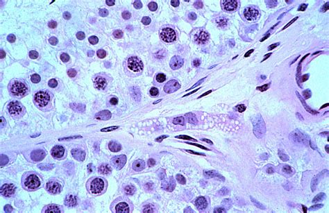 Hls [ Male Reproductive System Testis Leydig Cells] High Mag