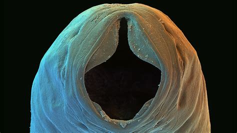 Slideshow: World's worst parasitic worms | Science | AAAS