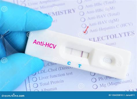 Hepatitis C Virus Positive Test Result Stock Photo - Image of checkup ...